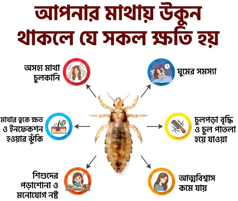 Offlice (Lice Remedy)